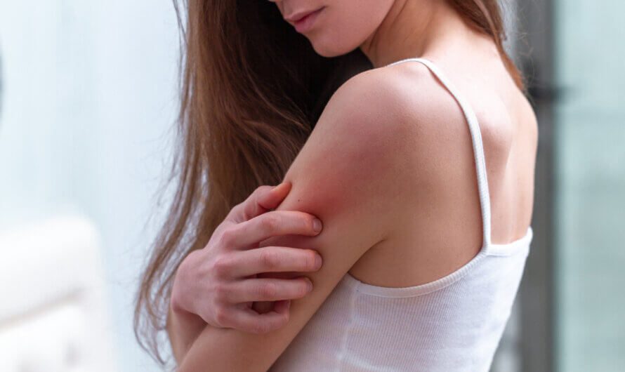 All You Need to Know About Skin Rashes